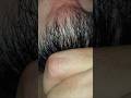 Beard hair #massage therapy #ingrownhair #relax #hairgrowth #skincare #shorts #video #viral