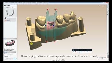How to design a digital implant model  with a Flexible Tissue in 3Shape