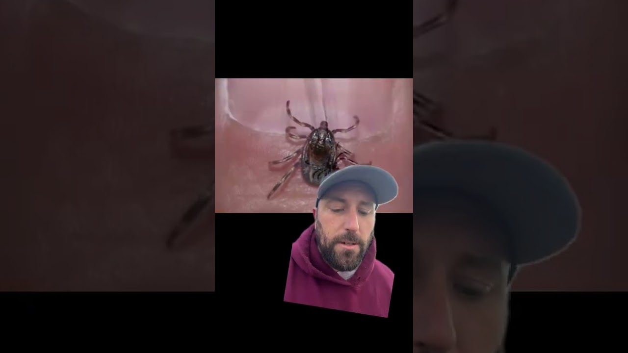Ticks