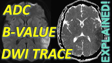 Diffusion Weighted Imaging EXPLAINED (DWI Trace, ADC, B-Values) | MRI Physics Course Lecture 14