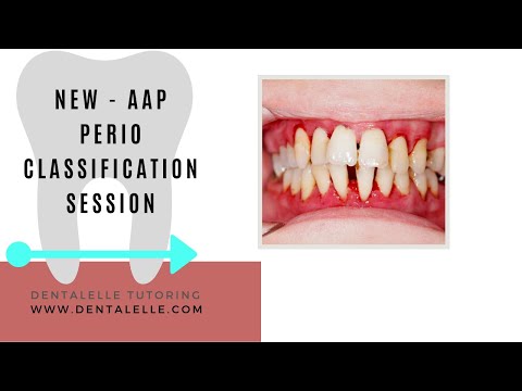 NEW AAP Perio Classification Session for the Board Exam