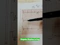 What Is Regular Rhythm In ECG Urdu Hindi Shorts ECG NormalRhythm