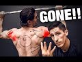 The Overhead Shoulder Pain Solution (GONE IN 4 STEPS!!)