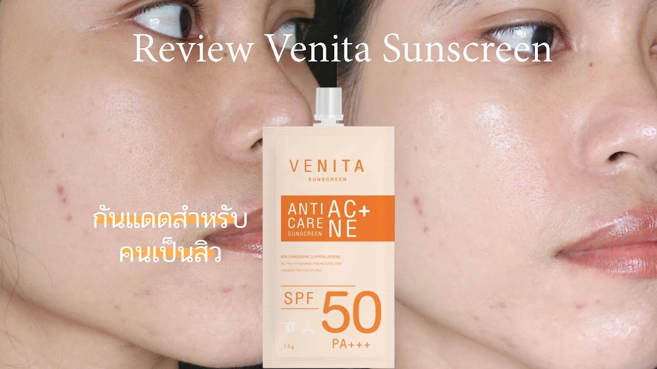 รีวิวกันแดด venita ที่เหมาะกับคนเป็นสิว ใช้แล้วเป็นไง? คุมมัน? เป็นสิว?