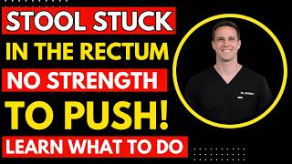 Stool STUCK in the Rectum! What is it and what to do? | Doctor Explains