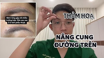 Không nên Nâng Cung Mày Đường Trên - Thảm hoạ KHÓ SỬA trong Thẩm Mỹ | Dr Dương Toàn