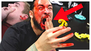 Can a fidget spinner cut you?