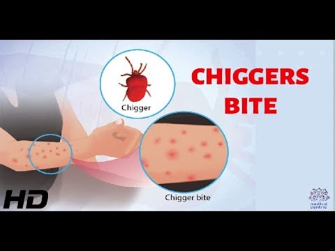 Video: Sunt insectele roșii contagioase?