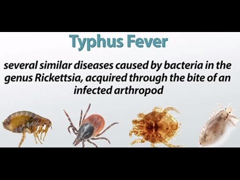 Vidéo: Typhus: Causes, Symptômes Et Diagnostic