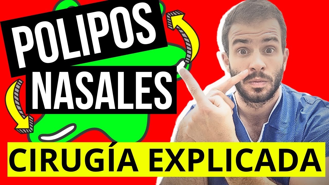 Como Destruir Los Polipos Nasales www.youtube.com
