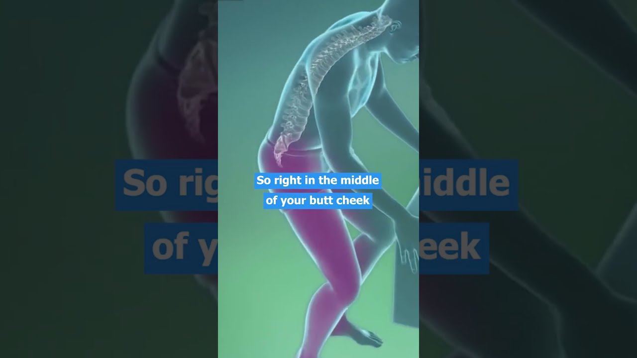 Sciatica Symptoms Pain And Sciatic Nerve Do You REALLY Have 