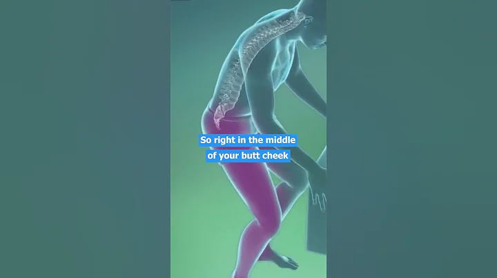 Sciatica Symptoms, Sciatica Pain and Sciatic Nerve 💡 Do You REALLY Have Sciatica? - DayDayNews