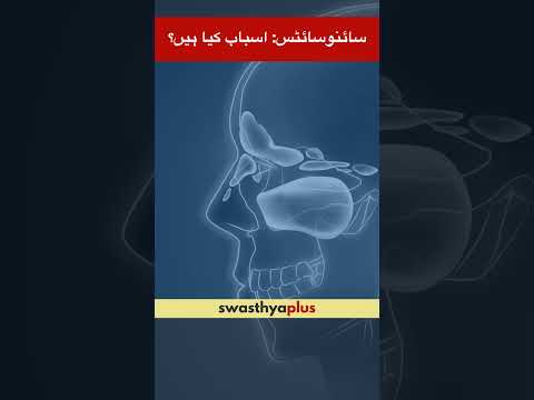 سائنوسائٹس: اسباب کیا ہیں؟ | Causes of Sinusitis | Sinus Infection | Dr Rehan Mehmood | #Shorts
