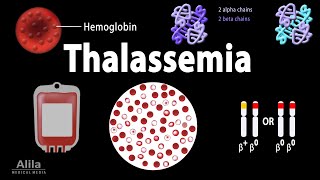 Thalassemia: Alpha \u0026 Beta-Thalassemias, Genetics, Pathophysiology, Diagnosis \u0026 Treatment, Animation