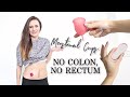 Menstrual Cups After Colon + Rectum Removal! | Let's Talk IBD