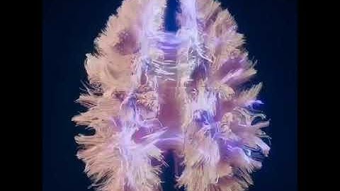 Video showing electrical activity of Brain 🧠:Electroencephalogram (EEG) test😱🤯💙