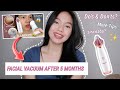 PORE VACUUM BLACKHEADS REMOVER 5 MONTHS UPDATE + Do's and Don'ts | Tips | Hello Katy