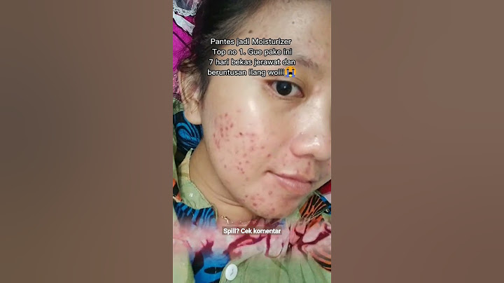 Pantes jadi moisturizer no 1 😭 hasilnya kek gini
