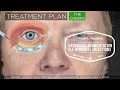 How Surgeons Fix Severe Dark Circles - Surgical Details | Aesthetic Minutes #Shorts #DarkCircles