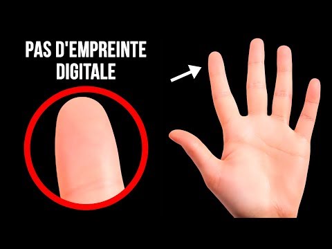 Vidéo: Les Scientifiques Ont Expliqué Pourquoi Et Pourquoi Une Personne A Besoin D'empreintes Digitales - Vue Alternative