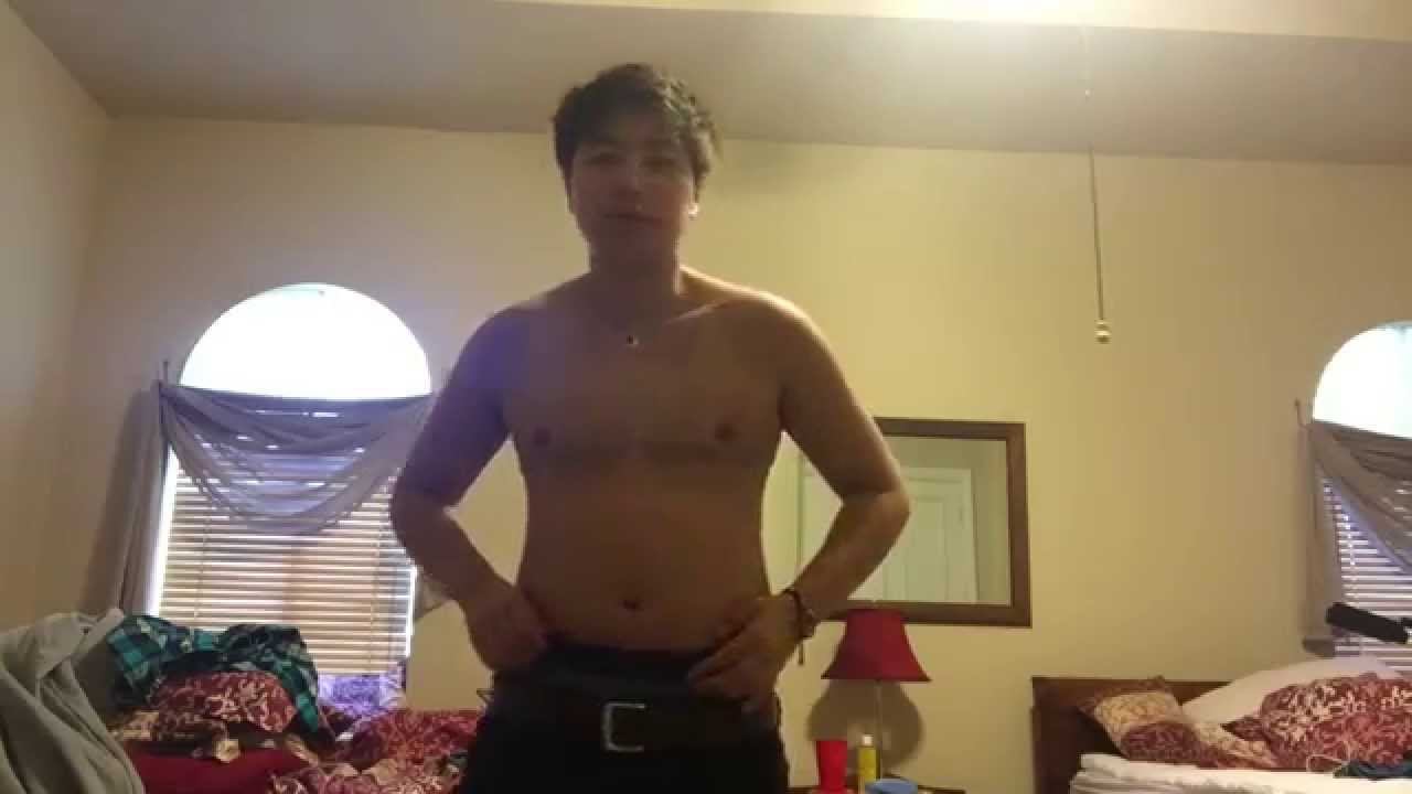 FTM Top Surgery - 1 week post op!