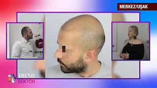 Uşak Saç Si̇mülasyonu Ve Kamuflaj Makyaj Merkezi̇ - Trend Sektör