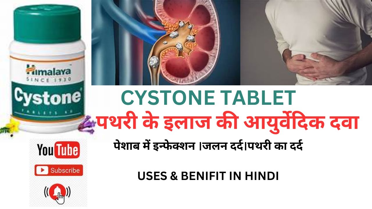 CYSTONE TABLET USES IN HINDI पेशाब में इन्फेक्शन ।जलन दर्द।पथरी का दर्द 