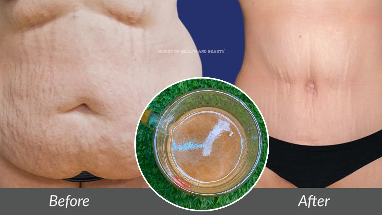 இத குடிக்க குடிக்க கொழுப்பு கரைந்து கொண்டே வரும்,thoppai kuraiya