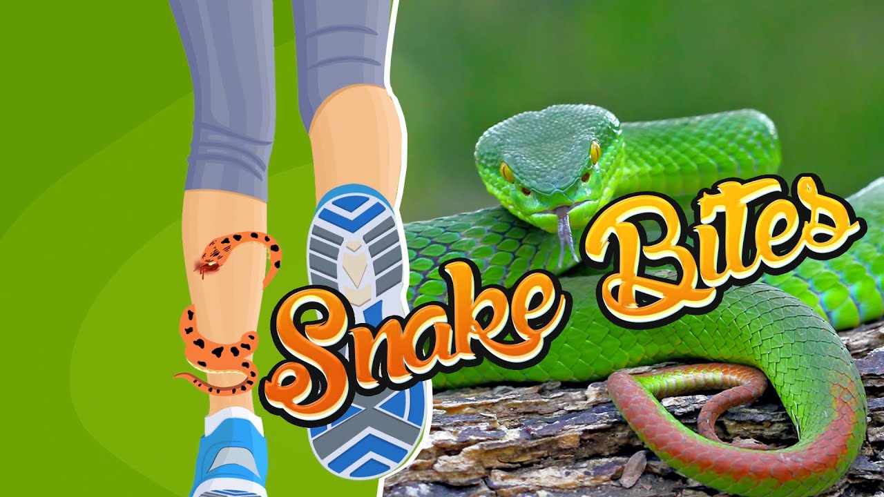 How To Survive a Venomous Snake Bite?