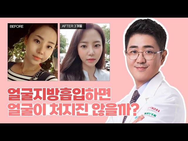 얼굴지방흡입하면 얼굴이 처지진 않을까?