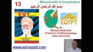 Nose 3 (Mosaad Abdel-Aziz): Rhinosinusitis & Its Complications