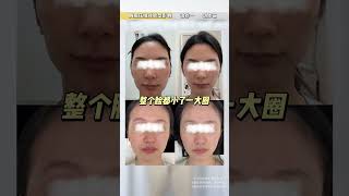 This Posture Is The Most Disfiguring Of One S Face Shape Square Face Rhombus Face One Step