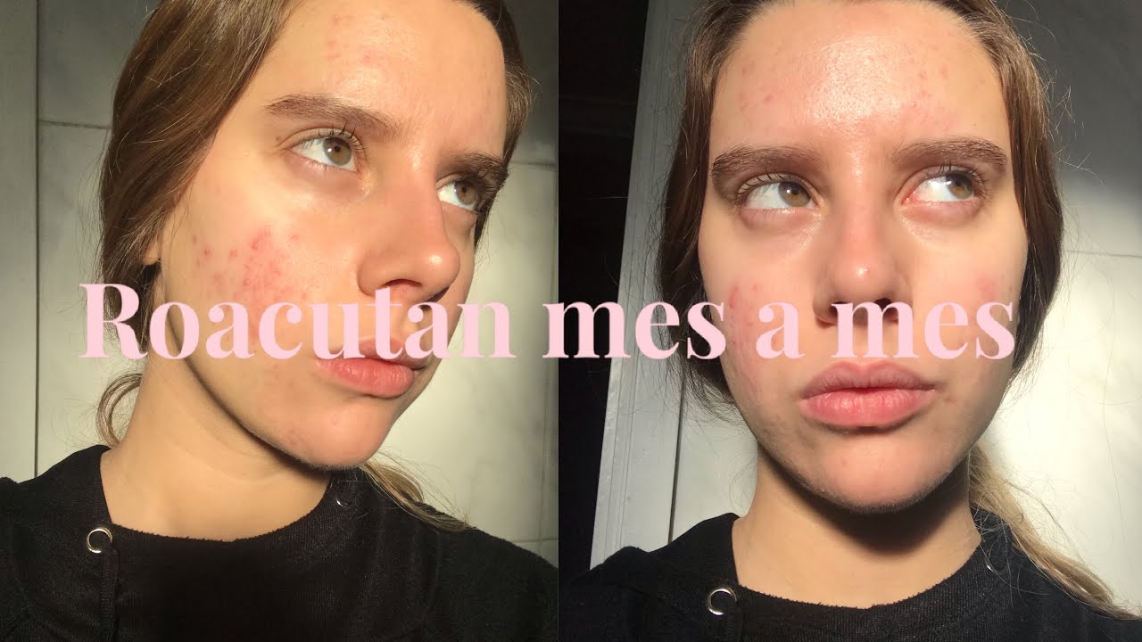 roacutan en el mostrador