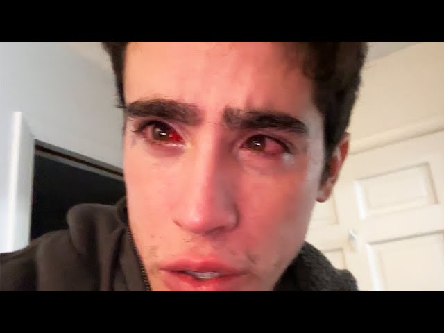 ANOTHER EYE SURGERY!? Plus Crazy Cab Story