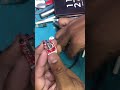 Dead Earpod Charging Problem Solved – Simple Trick to Fix It in Seconds