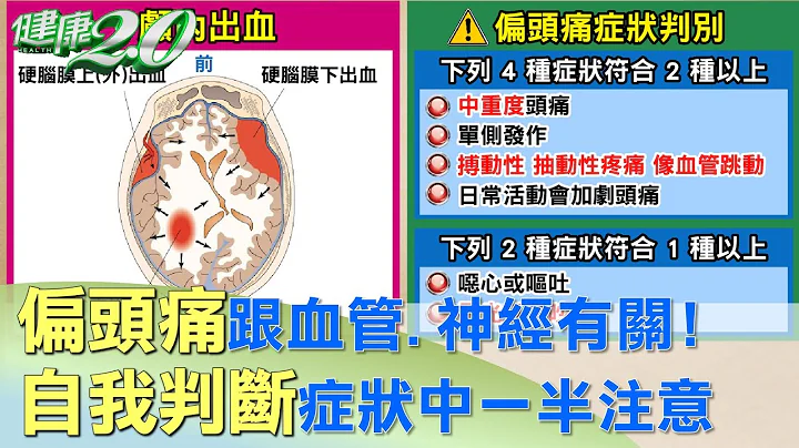 偏頭痛跟血管.神經有關！自我判斷症狀中一半注意 健康2.0 - 天天要聞