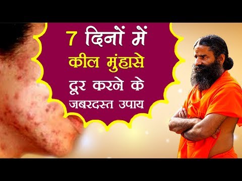 7 दिनों में कील मुंहासे दूर करने के जबरदस्त उपाय | Swami Ramdev