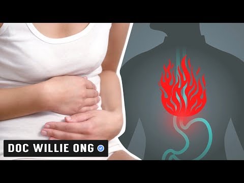 Video: 3 Mga Paraan upang Madali ang Mga Sintomas ng IBS Naturally