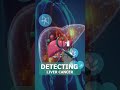 95% Accurate Liver Cancer Blood Test | NCI‑Validated Fusion HCC Predictor by MoleculeDx