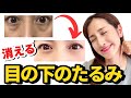 【感動の集中ケア】目の下のたるみ解消！スペシャルケアで徹底的に若返り★