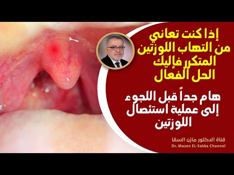 كيف تتخلص من التهاب اللوزتين والحلق بأسرع وقت وهل الحل عملية استئصال اللوز لماذا يحدث الالتهاب أصلا