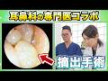 【現役ドクター対談】過去一大変だった時の副鼻腔炎の手術について語りました【好酸球性副鼻腔炎】