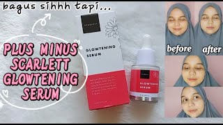 SCARLETT GLOW WHITENING SERUM (REVIEW PEMAKAIAN 1 BULAN)