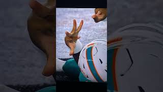 Tua Tagovailoa Injury😭😱 #shorts #nfl #short #nflfootball #shortvideo #miamidolphins
