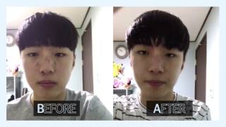 [g9skin] 지성, 속건성, 여드름피부에 똭!  AC솔루션 출시