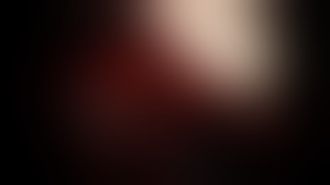 Single port VATS LUL lobectomy_Pulmonary artery division by EndoGIA tan (shaking)