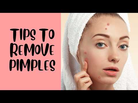 உங்கள் முகப்ருகளுக்கு சிறந்த டிப்ஸ் | Tips to remove pimples