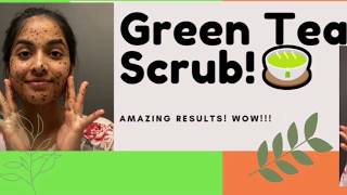 How to get rid of Acne Scars and Blemishes?| Green Tea Scrub