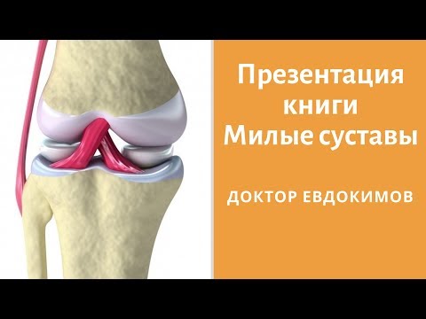 Презентация моей книги про артрозы и боли в суставах Милые суставы