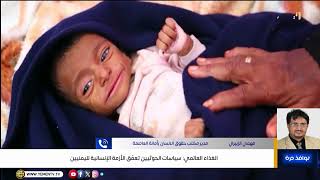الغذاء العالمي: سياسات الحوثيين تعمّق الأزمة الإنسانية لليم